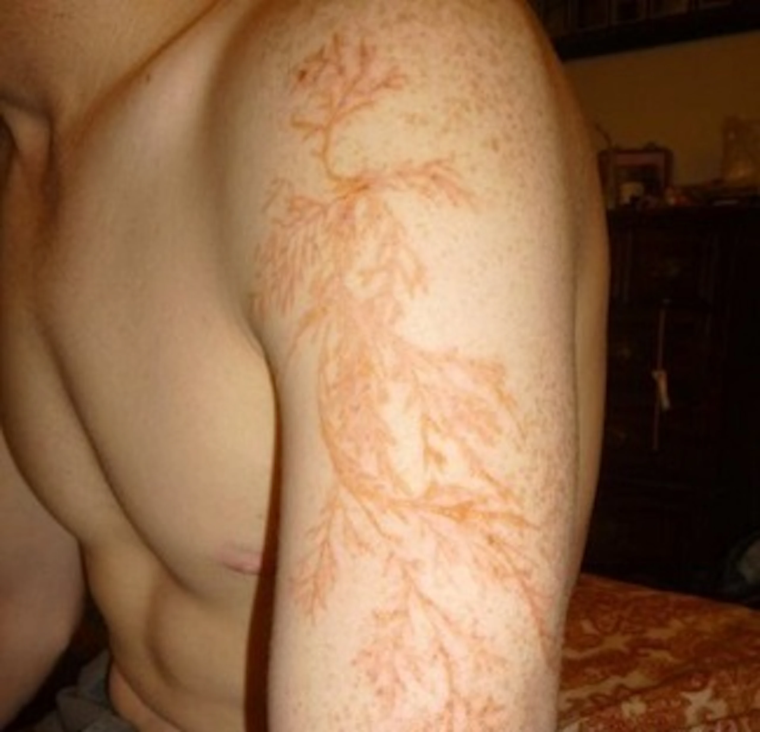 Lichtenberg pattern